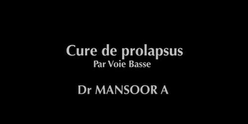 Prolapsus voie basse Mansoor A