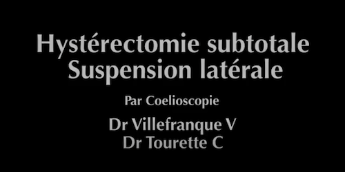Hysterectomie sub totale suspension latérale Villefranque V Tourette C
